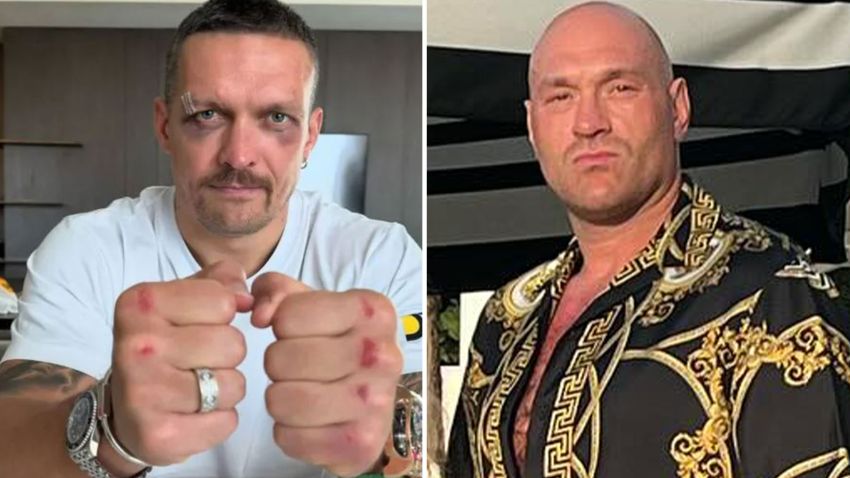Олександр Усик відреагував на чутки про те, що Ф'юрі зламав йому щелепу