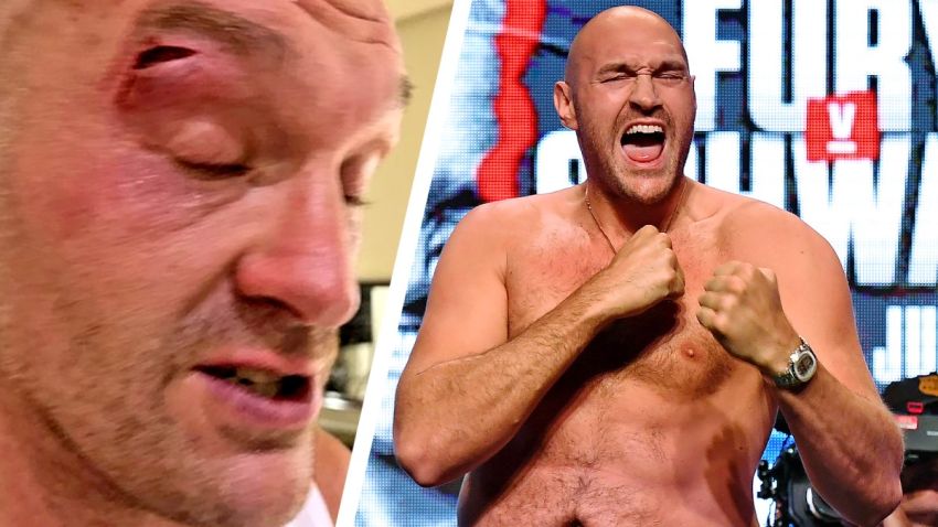 Промоутер Усика не вірить у виправдання Ф'юрі, щодо розсічення
