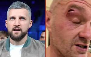 Карл Фроч поставив під сумнів правду про розсічення Ф'юрі: "Синяк виглядає так, ніби йому від семи до десяти днів"