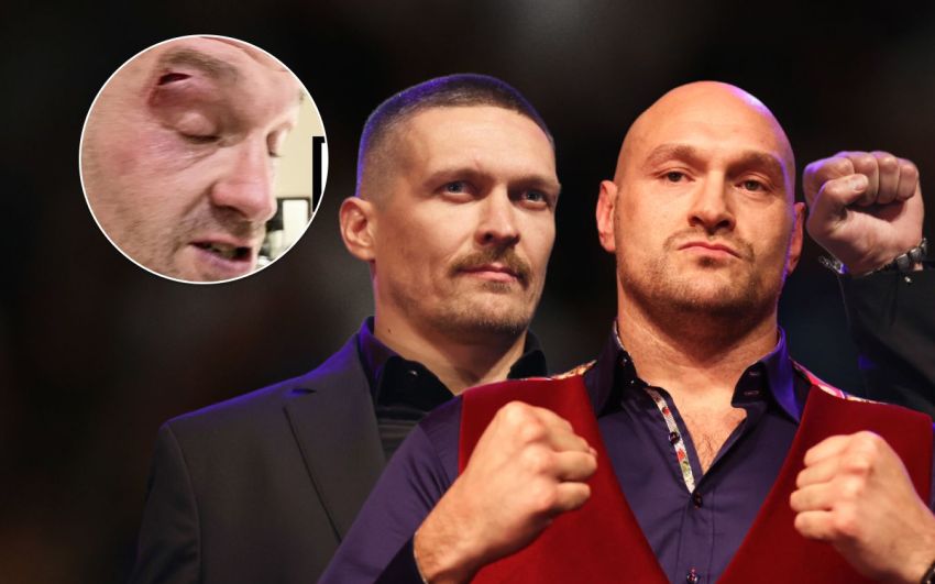Екс-тренер Дюбуа назвав причину розсічення у Тайсона Ф'юрі перед боєм з Олександром Усиком