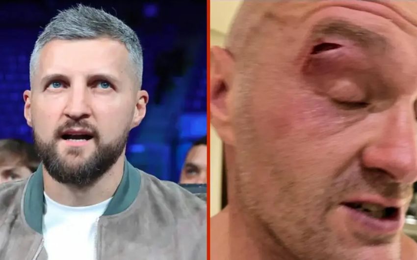 Карл Фроч поставив під сумнів правду про розсічення Ф'юрі: "Синяк виглядає так, ніби йому від семи до десяти днів"