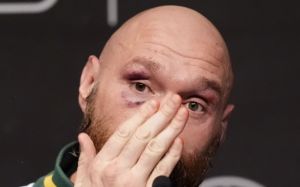 Володимир Хрюнов: "Ми побачимо бій Тайсона Ф'юрі та Федора Ємельяненка в "Лужниках"